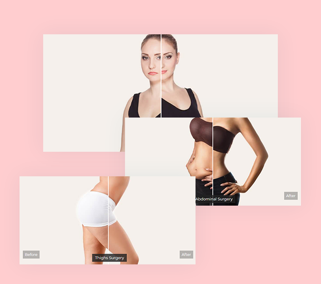 Portfolio of images in Cosmetic Surgery WordPress Theme